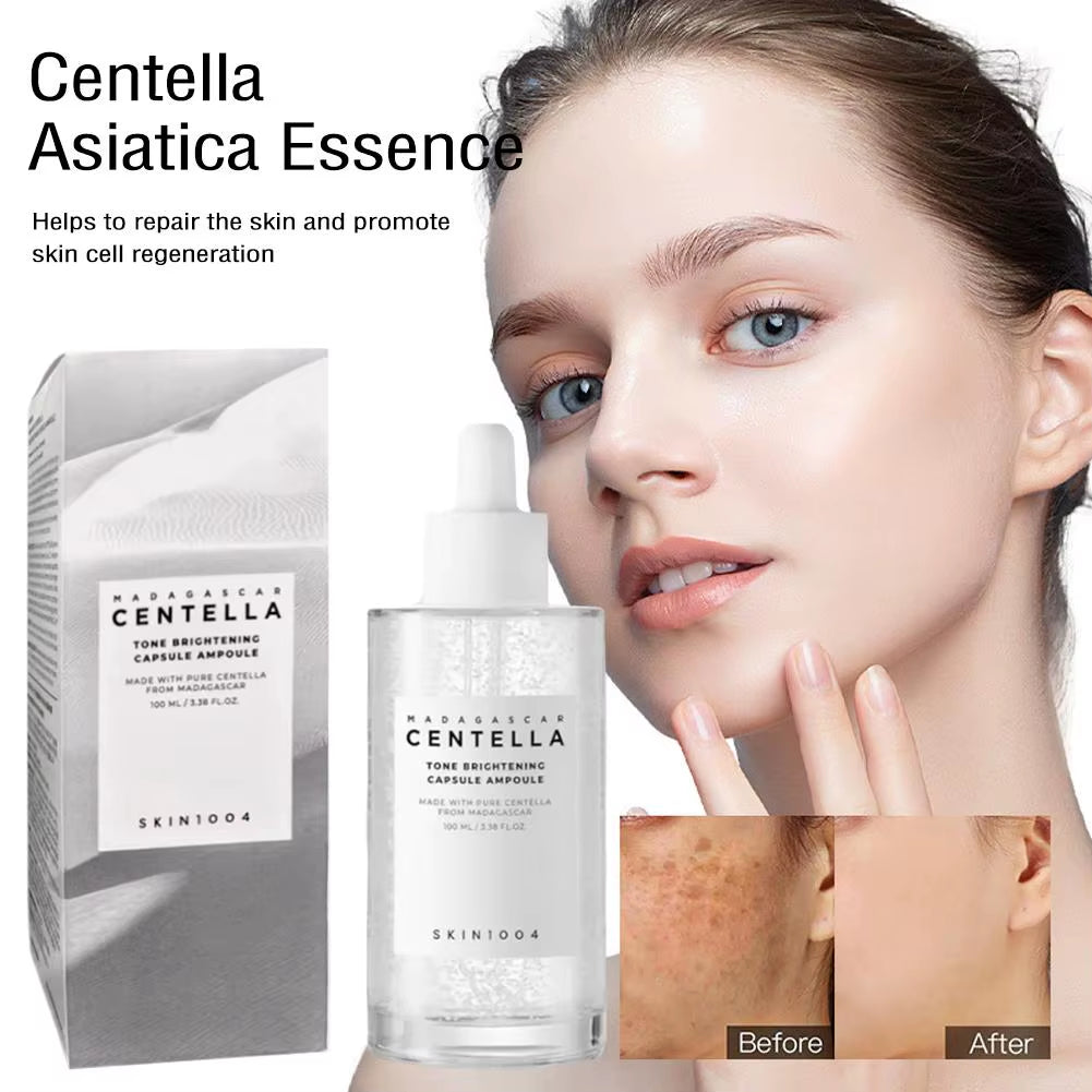 SKIN1004 Centella Asiatica Serum Korean Centella Toner Brightening Skin Moisturizing Water, Face Care Serum for All Skin Types