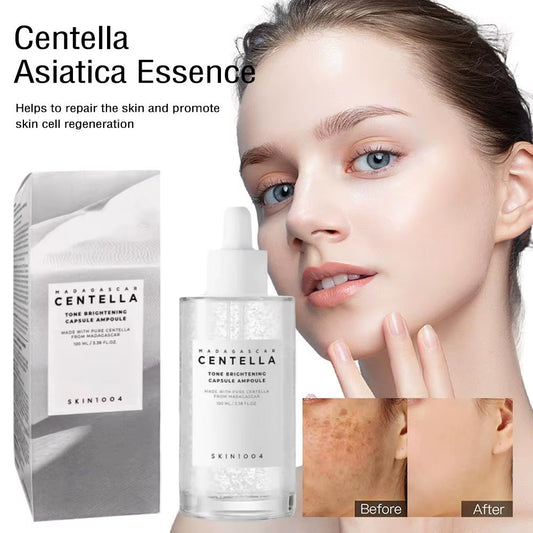 SKIN1004 Centella Asiatica Serum Korean Centella Toner Brightening Skin Moisturizing Water, Face Care Serum for All Skin Types